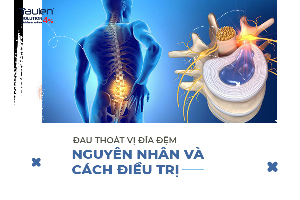 Đau thoát vị đĩa đệm - Nguyên nhân và cách điều trị