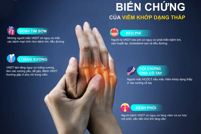 Viêm khớp dạng thấp làm ảnh hưởng đến niêm mạc khớp, rồi dần dần xói mòn xương và gây biến dạng cho các khớp