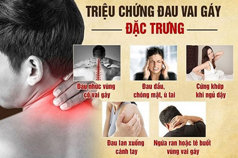 Đau vai gáy là biểu hiện của sự rối loạn chức năng cơ-xương-khớp ở vùng cổ vai gáy